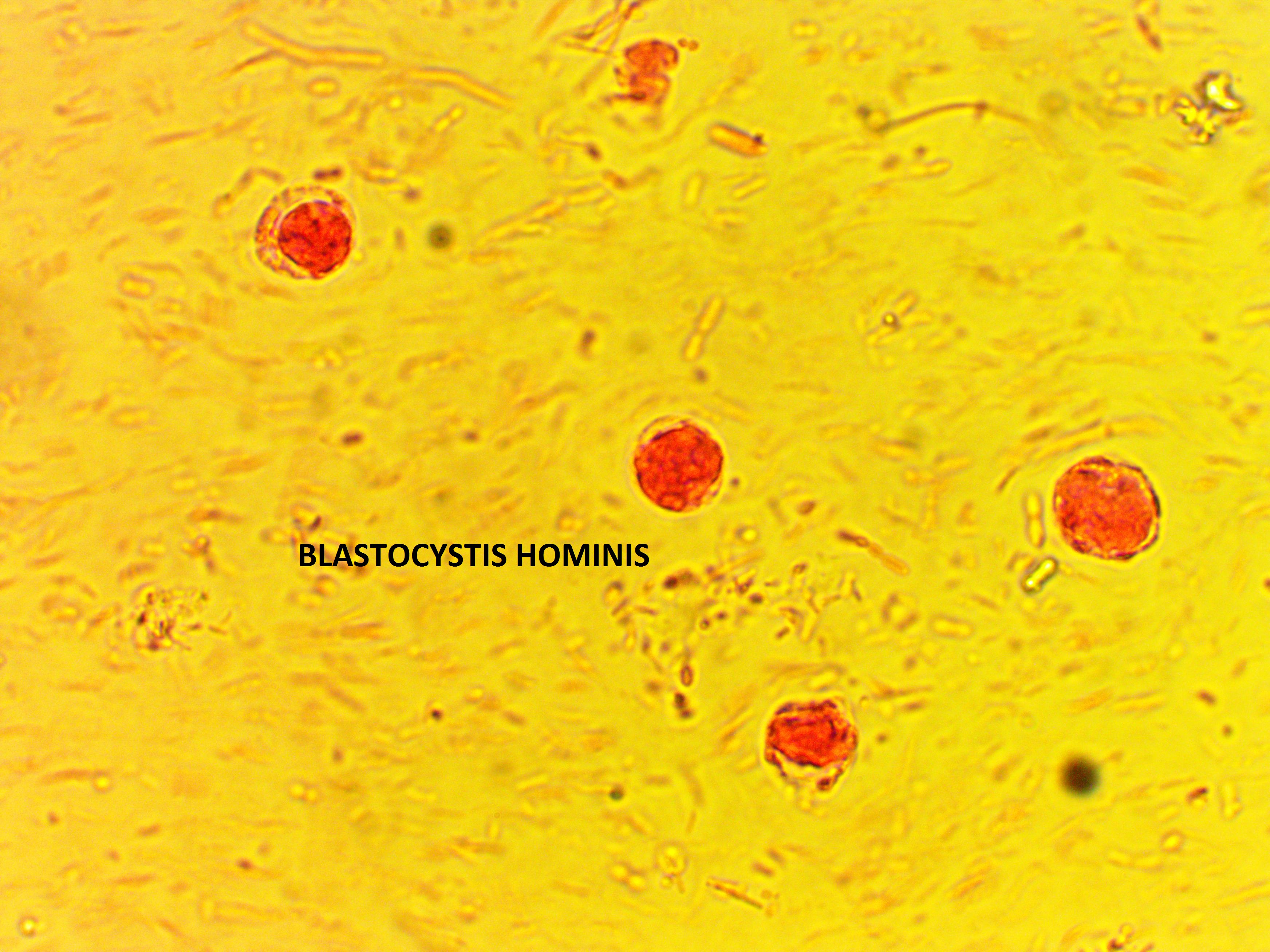 Blastocystis hominis dieta