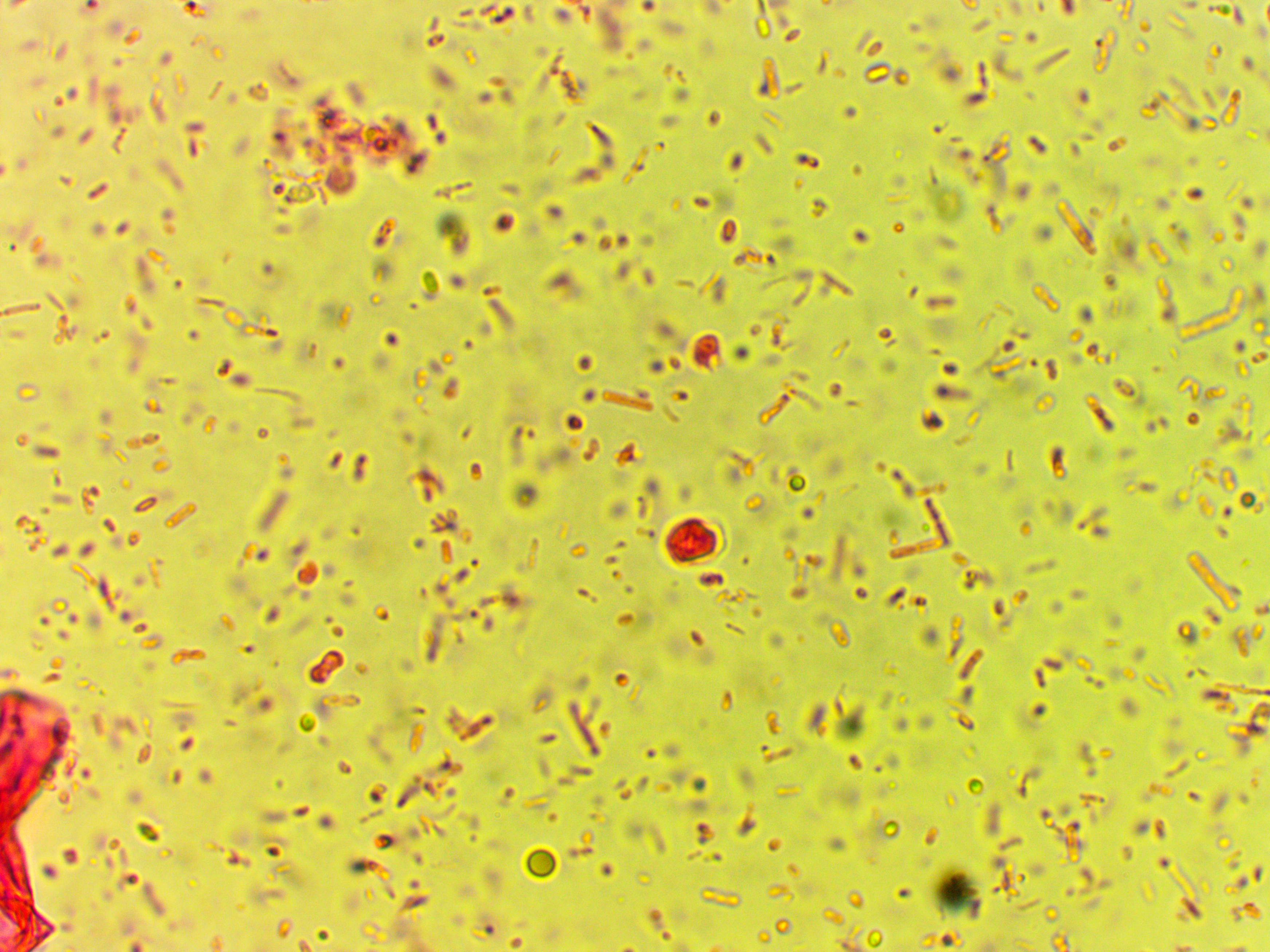 Parasitetesting